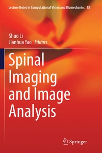 Enlarge image Cover: Spinal Imaging and Image Analysis - Springer
