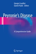 Cover: Peyronie's Disease - Springer