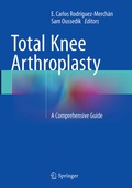 Cover: Total Knee Arthroplasty - Springer