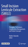 Cover: Small Incision Lenticule Extraction (SMILE) - Springer