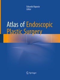 Abbildung von: Atlas of Endoscopic Plastic Surgery - Springer