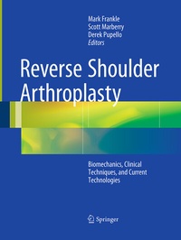 Abbildung von: Reverse Shoulder Arthroplasty - Springer