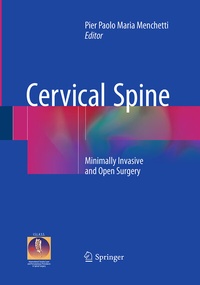 Abbildung von: Cervical Spine - Springer