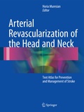 Bild: Arterial Revascularization of the Head and Neck - Springer