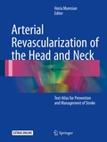 Bild: Arterial Revascularization of the Head and Neck - Springer