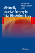Cover: Minimally Invasive Surgery in Total Hip Arthroplasty - Springer