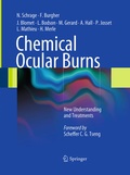Cover: Chemical Ocular Burns - Springer