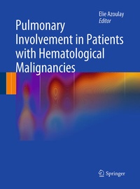 Bild: Pulmonary Involvement in Patients with Hematological Malignancies - Springer