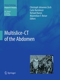 Cover: Multislice-CT of the Abdomen - Springer