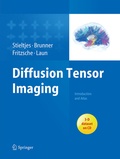 Cover: Diffusion Tensor Imaging - Springer