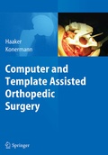 Cover: Computer and Template Assisted Orthopedic Surgery - Springer