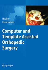 Enlarge image Cover: Computer and Template Assisted Orthopedic Surgery - Springer