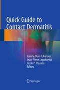 Cover: Quick Guide to Contact Dermatitis - Springer