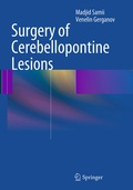 Cover: Surgery of Cerebellopontine Lesions - Springer