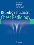 Cover: Radiology Illustrated: Chest Radiology - Springer