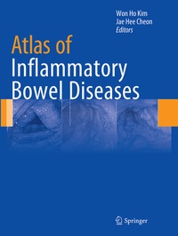 Abbildung von: Atlas of Inflammatory Bowel Diseases - Springer