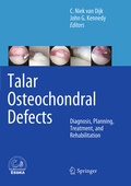 Cover: Talar Osteochondral Defects - Springer