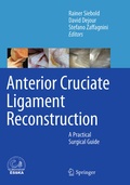 Cover: Anterior Cruciate Ligament Reconstruction - Springer