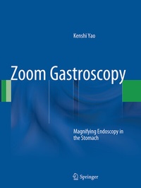Abbildung von: Zoom Gastroscopy - Springer
