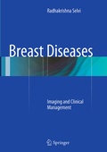 Abbildung von: Breast Diseases - Springer