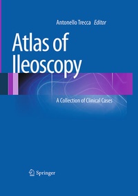 Abbildung von: Atlas of Ileoscopy - Springer