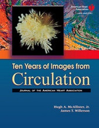 Enlarge image Cover: Ten Years of Images from Circulation - Lippincott Williams and Wilkins