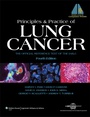 Cover: Principles and Practice of Lung Cancer - Lippincott Williams and Wilkins