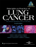 Cover: Principles and Practice of Lung Cancer - Lippincott Williams and Wilkins