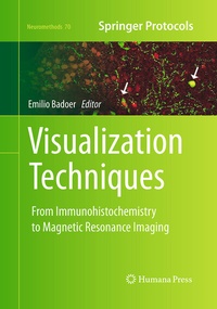 Abbildung von: Visualization Techniques - Humana Press Inc.