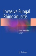 Cover: Invasive Fungal Rhinosinusitis - Springer