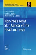 Cover: Non-melanoma Skin Cancer of the Head and Neck - Springer