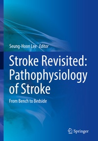 Abbildung von: Stroke Revisited: Pathophysiology of Stroke - Springer