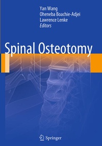 Enlarge image Cover: Spinal Osteotomy - Springer