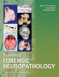 Abbildung von: Essential Forensic Neuropathology - Lippincott Williams and Wilkins