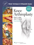 Cover: Master Techniques in Orthopaedic Surgery: Knee Arthroplasty - Lippincott Williams and Wilkins