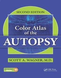 Enlarge image Cover: Color Atlas of the Autopsy - CRC Press