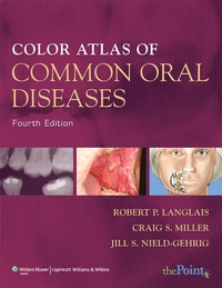 Abbildung von: COLOR ATLAS OF COMMON ORAL DISEASES 4E - Lippincott Williams and Wilkins