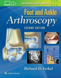 Abbildung von: Foot & Ankle Arthroscopy - Lippincott Williams and Wilkins