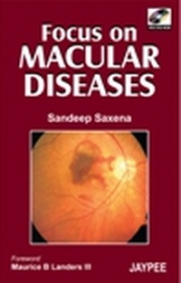 Abbildung von: Focus on Macular Diseases - Lippincott Williams and Wilkins