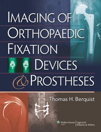 Enlarge image Cover: Imaging of Orthopaedic Fixation Devices and Prostheses - Lippincott Williams and Wilkins