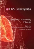 Cover: Idiopathic Pulmonary Fibrosis - European Respiratory Society
