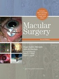 Cover: Macular Surgery - Lippincott Williams and Wilkins