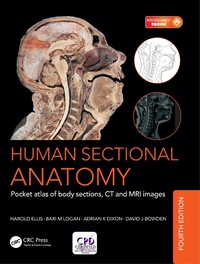 Abbildung von: Human Sectional Anatomy - CRC Press