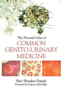 Abbildung von: The Pictorial Atlas of Common Genito-Urinary Medicine - CRC Press