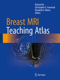 Abbildung von: Breast MRI Teaching Atlas - Springer