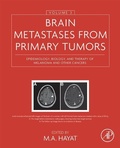 Bild: Brain Metastases from Primary Tumors, Volume 3 - Academic Press