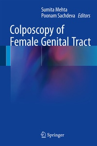 Abbildung von: Colposcopy of Female Genital Tract - Springer