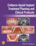 Cover: Evidence-based Implant Treatment Planning and Clinical Protocols - Wiley-Blackwell
