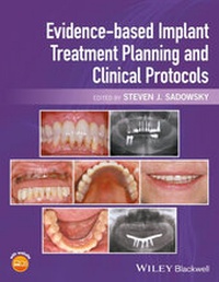 Abbildung von: Evidence-based Implant Treatment Planning and Clinical Protocols - Wiley-Blackwell
