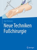 Cover: Neue Techniken Fu&szlig;chirurgie - Springer